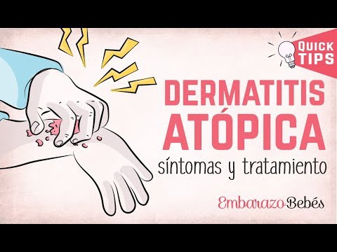 La dermatitis atópica en bebés: causas y tratamientos para la piel escamosa